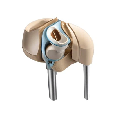 Zamenjava kolena zaradi artritisa